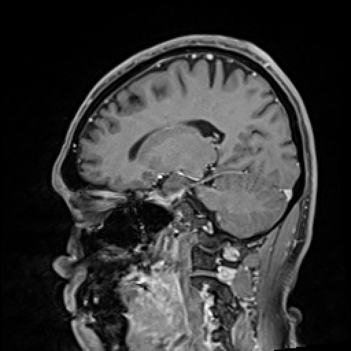 Click on the Serie image to view the images of VILLANUEVA, WILLIAM A.